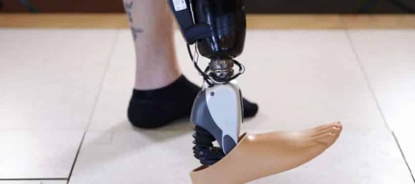 ossur sensor controlled bionic foot